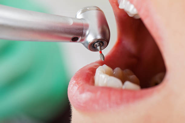 Best Emergency Dental Care for Trauma or Injury in , DC